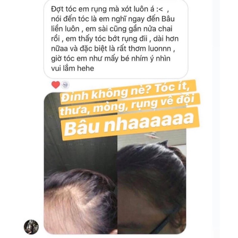 POMELO HAIR MIST - Xịt bưởi kích thích mọc tóc | BigBuy360 - bigbuy360.vn