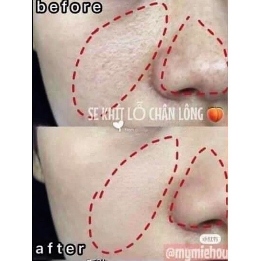Tinh chất se lỗ chân lông PORE TREATMENT | BigBuy360 - bigbuy360.vn