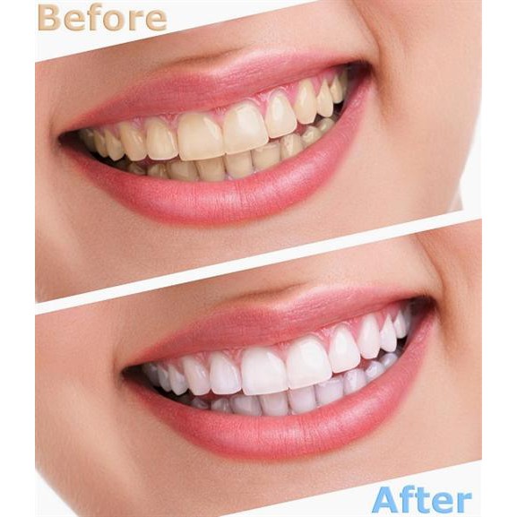 Bột Trắng Răng Eucryl 50g làm sạch răng, trắng răng và cho hơi thở thơm mát hơn