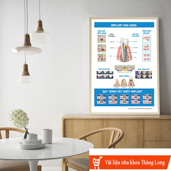 TRANH TƯ VẤN NHA KHOA CHỦ ĐỀ '' IMPLANT NHA KHOA''