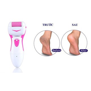 Máy tẩy tế bào chết, máy mài gót chân