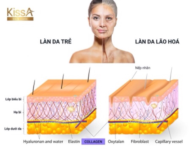 Kem dưỡng trắng da toàn thân Collagen KissA