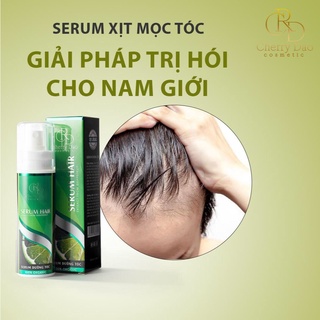 Xịt mọc tóc - Serum tóc - Serum mọc tóc - Serum dưỡng tóc - Kích mọc tóc