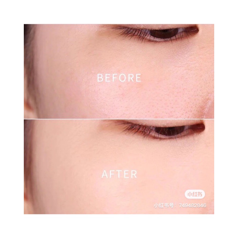 🍑 𝗛𝗘𝗥𝗔 𝗕𝗟𝗔𝗖𝗞 𝗙𝗢𝗨𝗡𝗗𝗔𝗧𝗜𝗢𝗡 𝟭𝟬𝗺𝗹