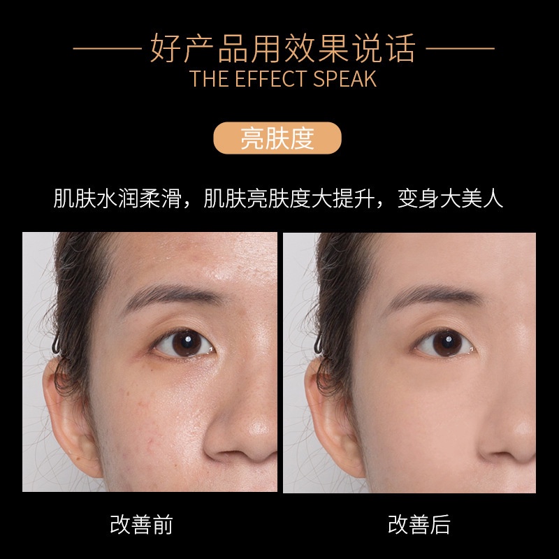 Bộ Sản Phẩm Dưỡng Ẩm Làm Sáng Da Caviar