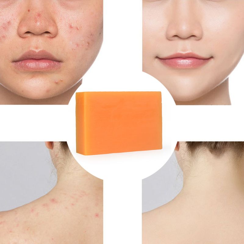 100g Handmade Kojic Acid Essential Oil Soap Dark Black Skin Whitening Brighten Face Body Deep Cleansing Mites Removal Moisturizi