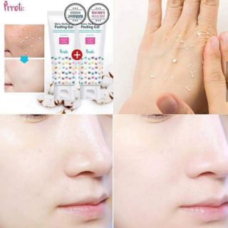 Tẩy da chết PEELING GEL PRRETI