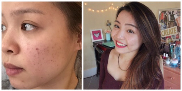 🍊Serum hỗ trợ làm giảm thâm mụn và sáng da MURAD Rapid Age Spot And Pigment Lightening | BigBuy360 - bigbuy360.vn