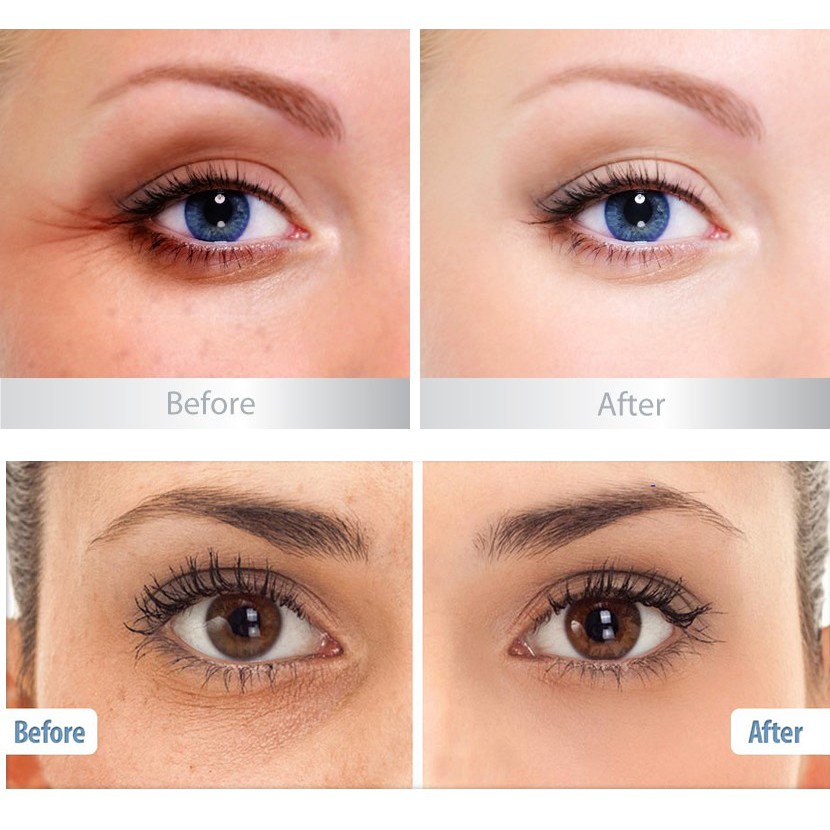 Kem Tái Tạo Và Dưỡng Da Mắt Balance Active Formula Gold Collagen Rejuvenating Eye 15ml | BigBuy360 - bigbuy360.vn