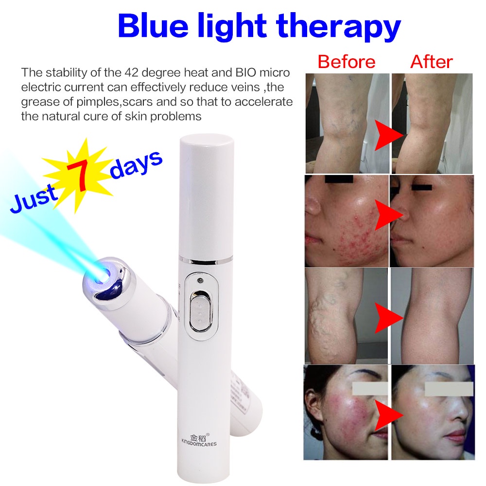 Bút laser xóa sẹo giảm mụn nếp nhăn / giãn tĩnh mạch / vết thương hiệu quả