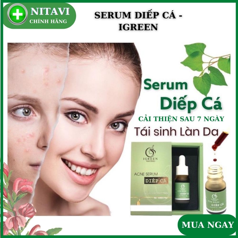 Serum diếp cá Igreen giảm mụn thâm mụn bọc tái tạo da hiệu quả sau 7 ngày