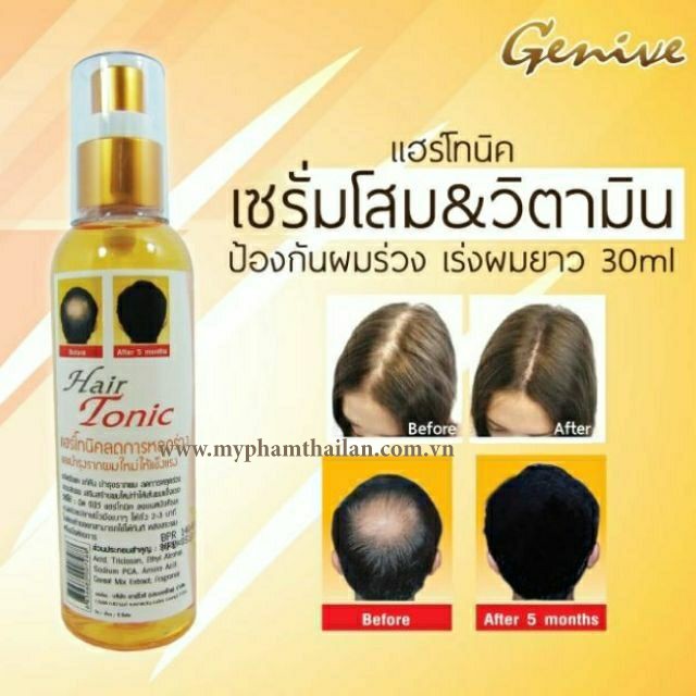 Chai Xịt Mọc Tóc GENIVE Thái Lan 120ml  Tonic Hair - Xịt Kích Mọc Tóc, Chống Rụng Tóc