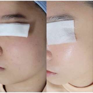 Mặt nạ Christina Biophyto 6A 𝘀𝗮̣𝗰𝗵 𝘀𝗮̂𝘂 𝘃𝗮̀ 𝘁𝗵𝘂 𝗹𝗼̂̃ 𝗰𝗵𝗮̂𝗻 𝗹𝗼̂𝗻𝗴 𝗵𝗶𝗲̣̂𝘂 𝗾𝘂𝗮̉