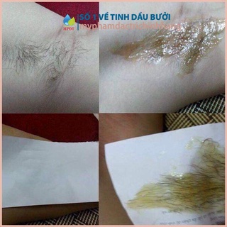 Combo triệt lông vĩnh viễn Wax + Mỡ Trăn