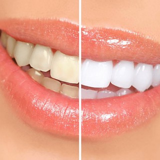 Kem Đánh Răng Crest 3D White Advanced Whitening 158g