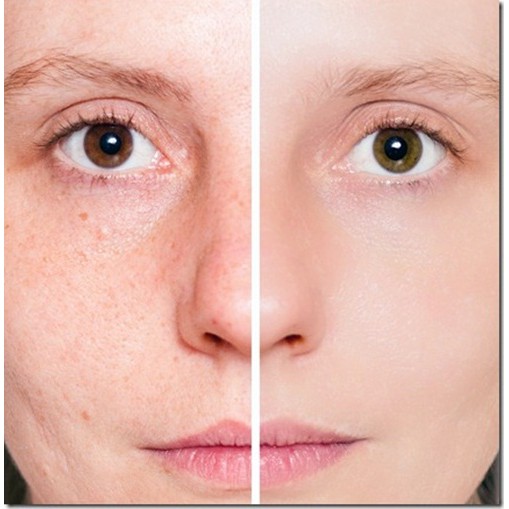 Tinh Dầu Nụ Tầm Xuân NOW Solutions Rose Hip Seed Oil 30ml serum dưỡng sáng da mịn màng căng bóng