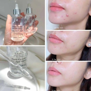 Tinh chất serum làm sáng da mờ thâm mụn Clearly Corrective Dark Spot Solution 50ml