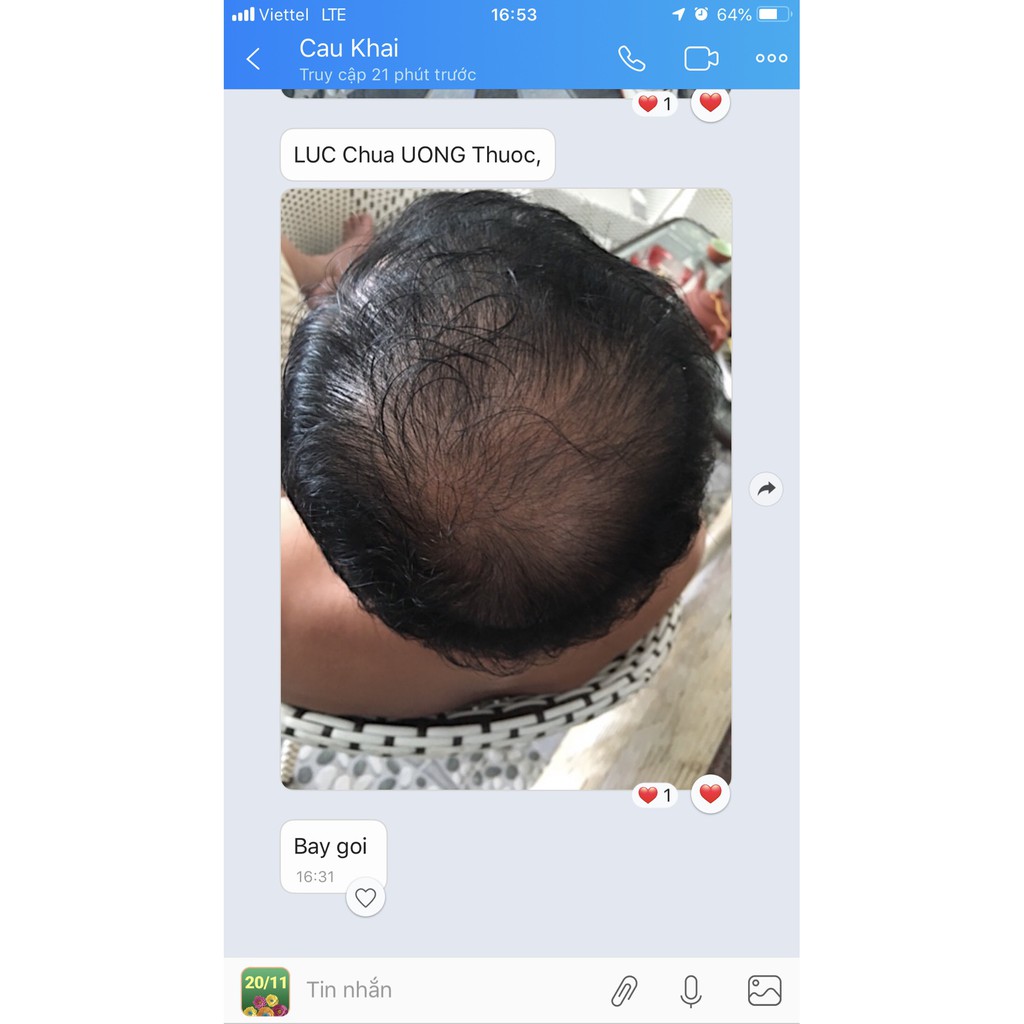 Viên uống Erocante giảm rụng tóc,giúp mọc tóc và hỗ trợ đen tóc, hộp 90 viên uống trong 45 ngày