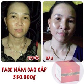 FACE NÁM SICA WHITE