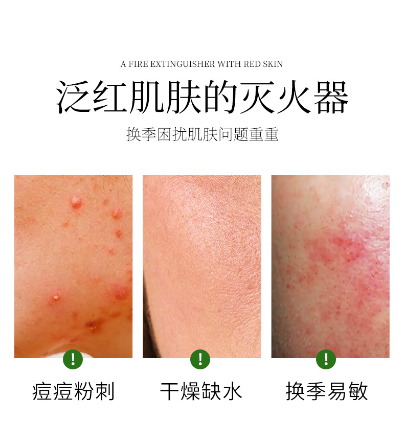 (hàng mới về) gel lô hội dưỡng ẩm hỗ trợ giảm mụn thu nhỏ lỗ chân lông centella asiatica