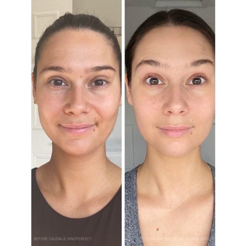 𝐒𝐞𝐫𝐮𝐦 𝐂𝐚𝐮𝐝𝐚𝐥𝐢𝐞 giảm nám dưỡng ẩm trắng da