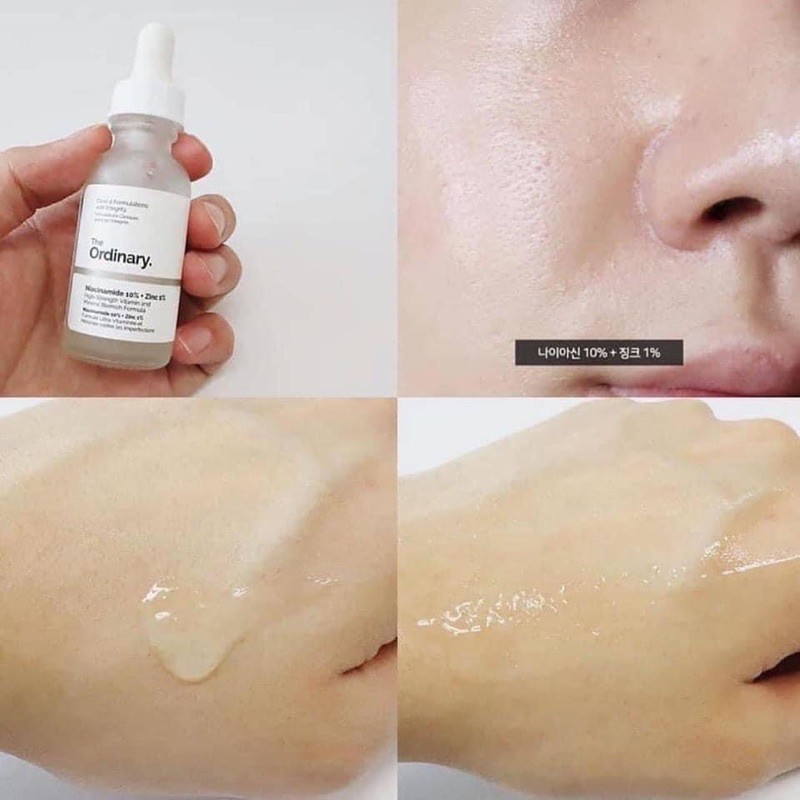 Tinh chất trị thâm mụn The Ordinary Niacinamide 10% + ZinC 1%