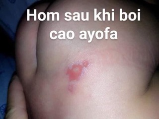 Cao thảo mộc ayofa(cao mát xa đa năng)