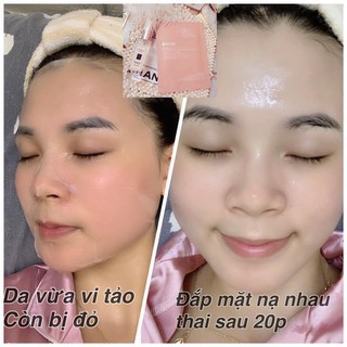 Mặt nạ nhau thai Nhật