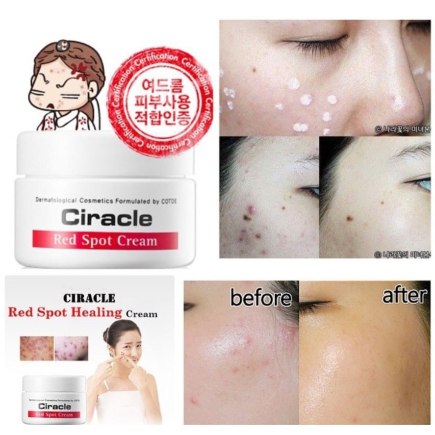 Kem Mụn Sưng Đỏ Ciracle Red Spot Cream