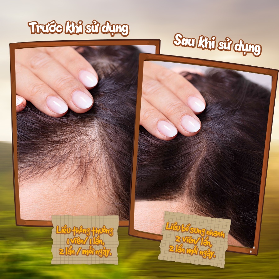 Viên uống kích thích mọc tóc, giảm rụng tóc Hairtonic chống bạc tóc, cải thiện khô tóc hiệu quả, an toàn từ thiên nhiên
