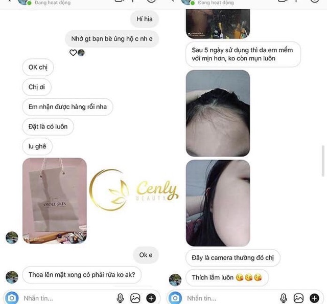 Serum Trị Mụn Amoli | BigBuy360 - bigbuy360.vn