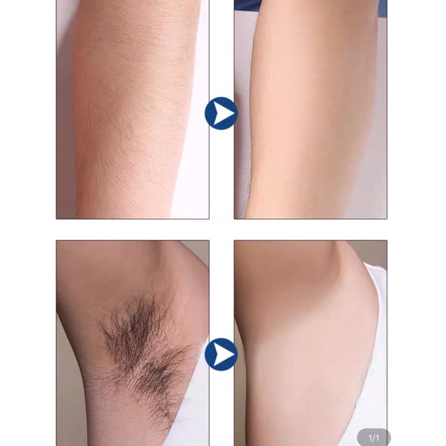 KEM TẨY LÔNG MẶT VÀ BODY NAIR