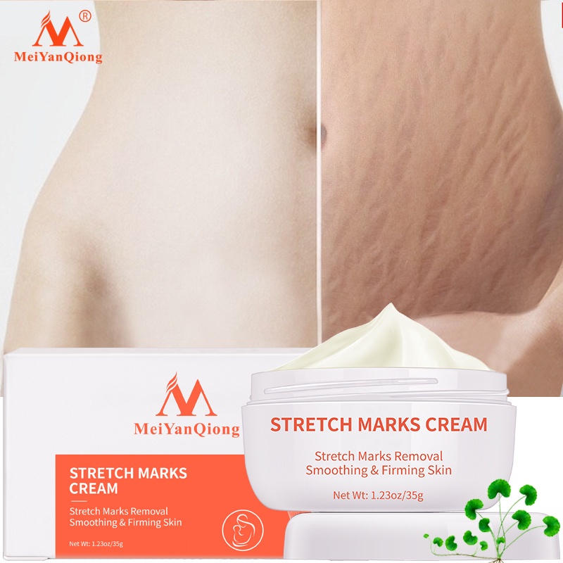 Meiyanqiong Stretch Mark Cream Làm Trắng Và Săn Chắc Mịn Mượt Chống Lão Hóa Giảm rạn da Kem dưỡng ẩm 35g
