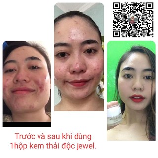 Kem thải độc Jewel Hàn quốc