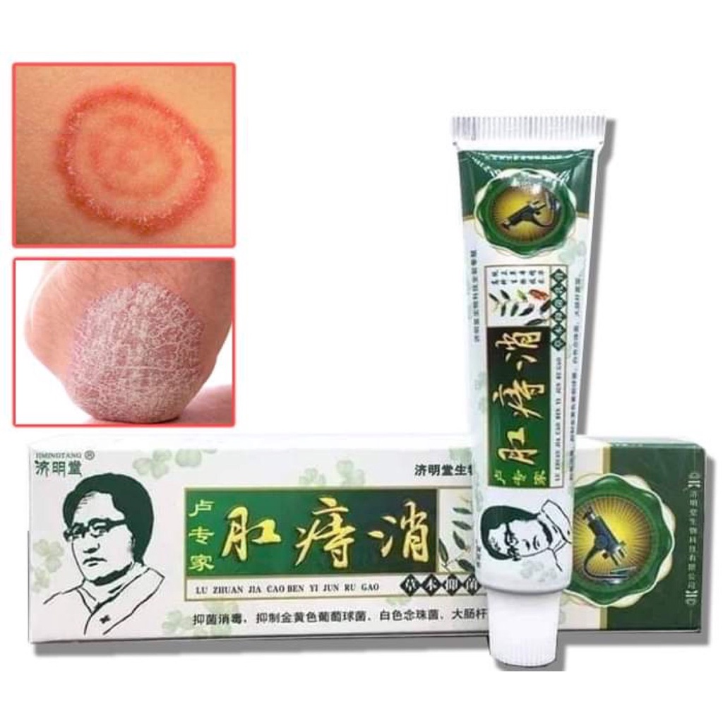 Kem bôi ngoài da, bôi ngứa, viêm da cơ địa(xanh lá trắng)