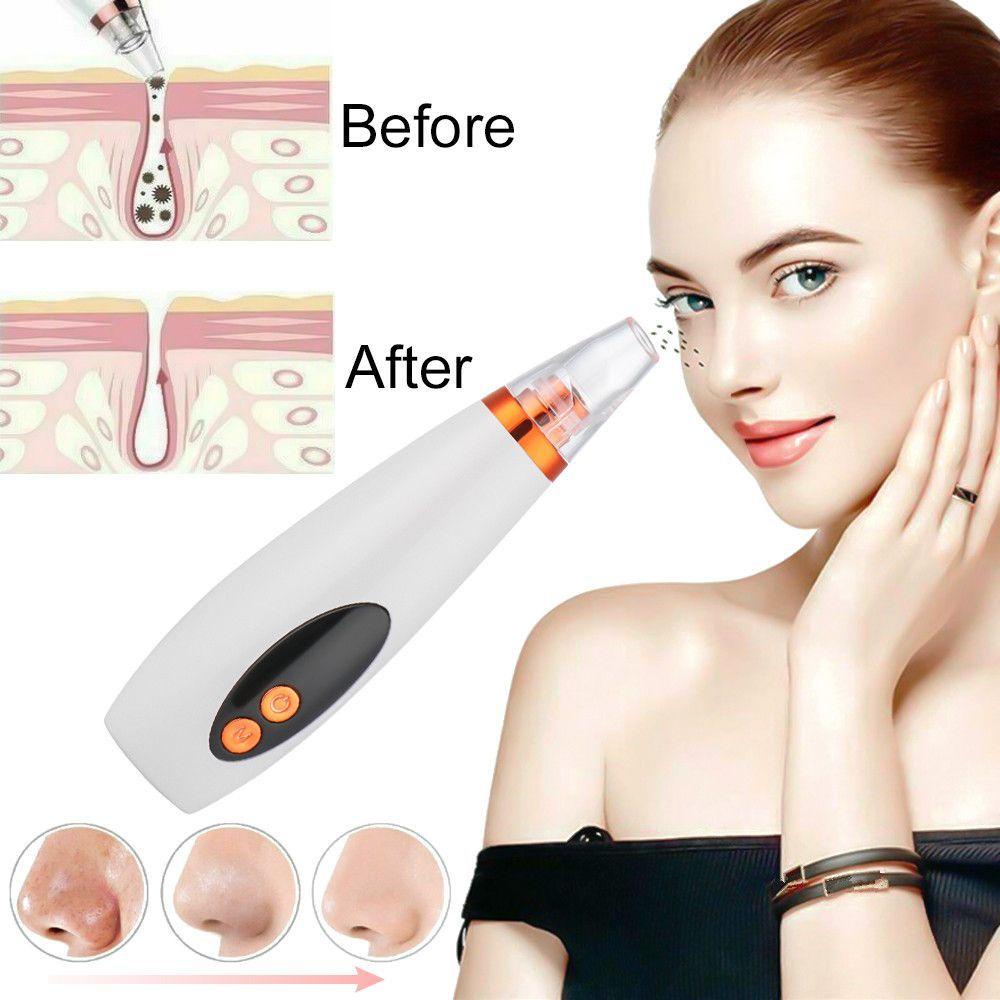 WATTLE Máy Hút Mụn Đầu Đen Làm Sạch Sâu Lỗ Chân Lông