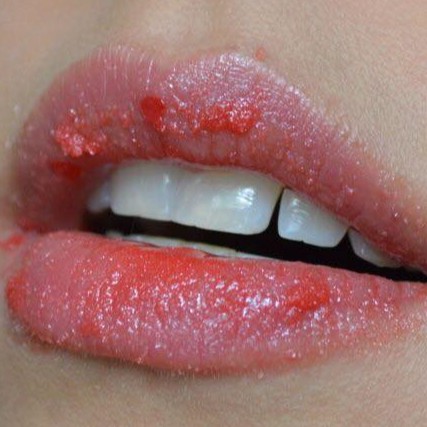 Beauty Treats - Tẩy tế bào chết môi Beauty Treats Lip Scrub | BigBuy360 - bigbuy360.vn