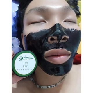 [free ship] lột sạch  mụn cám, đầu đen .(quyên lara)