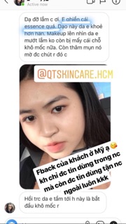 Nước Thần Dưỡng Da - Essence Lifting