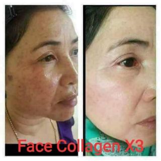 FACE Collagen X3
