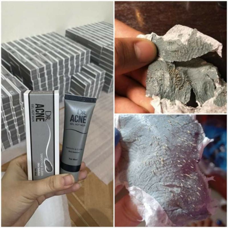 [ Hàng Hót ] Gell Lột Mụn DR.ACNE cty Hải Âu