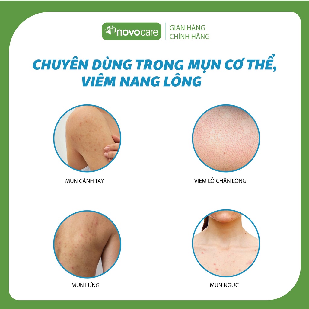 Gel tắm ngừa mụn & Xịt mụn lưng dùng cho da mụn, viêm nang lông, viêm da Novocare-Freeskin, sạch mụn, mờ thâm 250 & 80ml