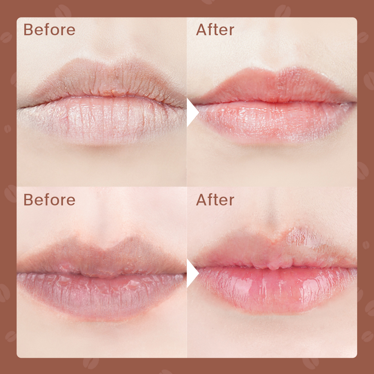 son dưỡng môi Son Dưỡng Môi Derol 100% Collagen Chính Hãng | BigBuy360 - bigbuy360.vn