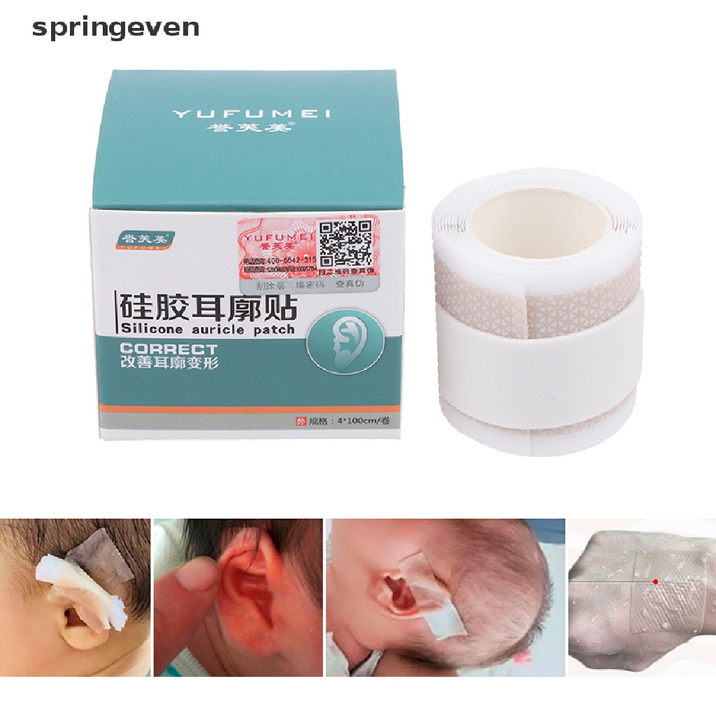 Miếng Dán Điều Chỉnh Tư Thế Tai Cho Bé Sơ Sinh 4 * 50cm
