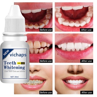Tinh Chất Làm Trắng Răng 30ml Chất Lượng Cao