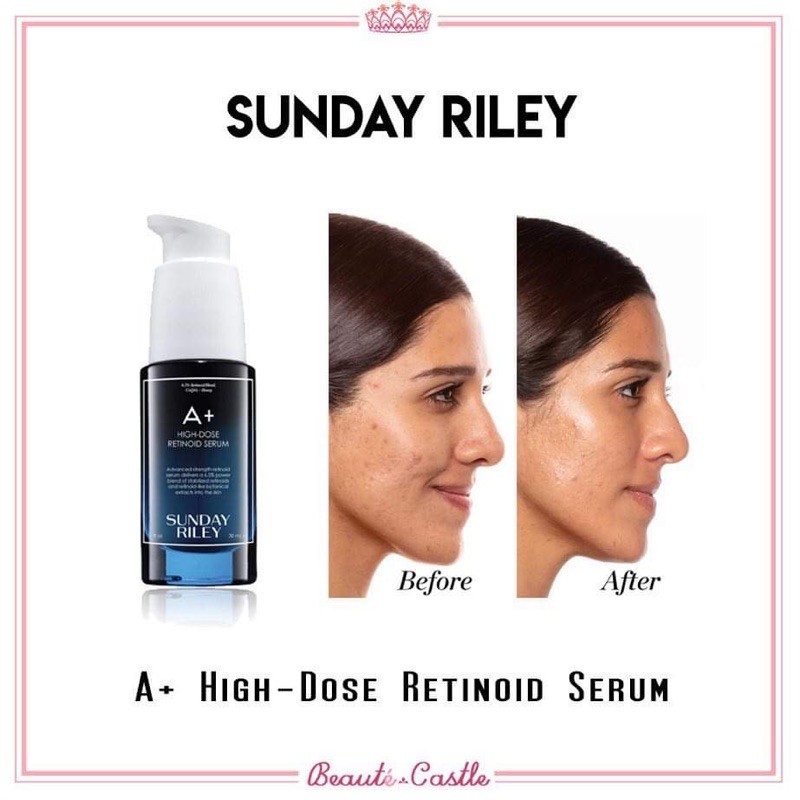 [AUTH] SUNDAY RILEY GÓI TINH CHẤT CHỐNG LÃO HOÁ A+ HIGH-DOSE RETINOL SERUM 1ML NỘI ĐỊA MỸ | BigBuy360 - bigbuy360.vn