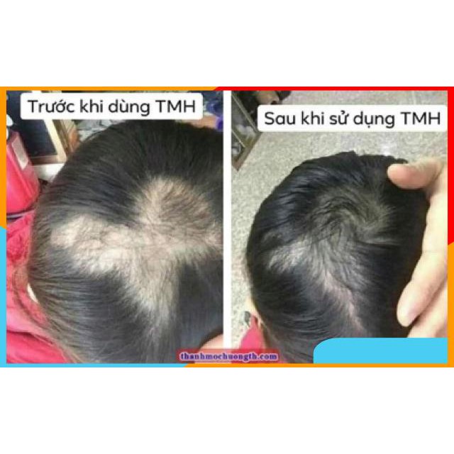 ✅CHÍNH HÃNG 100%✅ Dầu gội thảo dược Thanh Mộc Hương