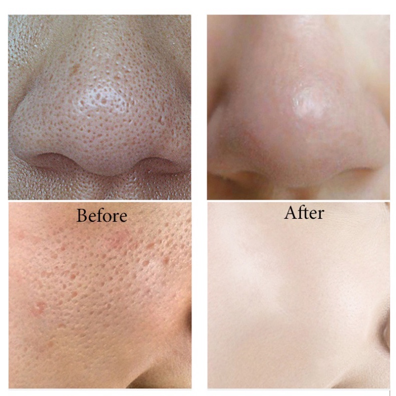 Mặt na lột mụn đầu đen bùn núi lửa Noro hộp 100ml NMN4