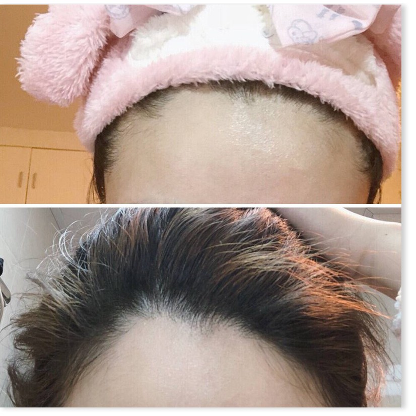 Phấn che khuyết điểm  💯 GIÁ VỐN]   Phấn che khuyết điểm chân tóc Maycheer cho mái tóc thêm dày và đầy đặn hơn 6579 | BigBuy360 - bigbuy360.vn