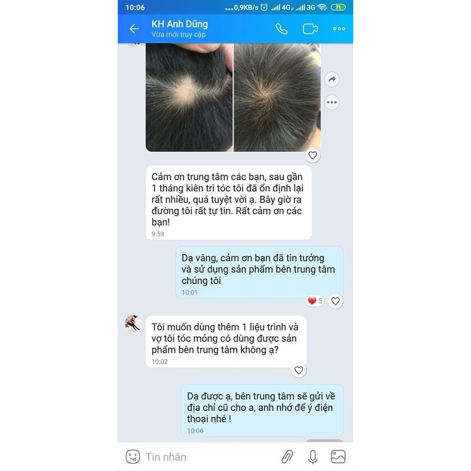 Viên uống Alika Ultra for men Giảm Rụng Tóc, Hỗ trợ Kích Thích Mọc Tóc và Hỗ Trợ Đen Tóc, hộp 60 viên | Thế Giới Skin Care